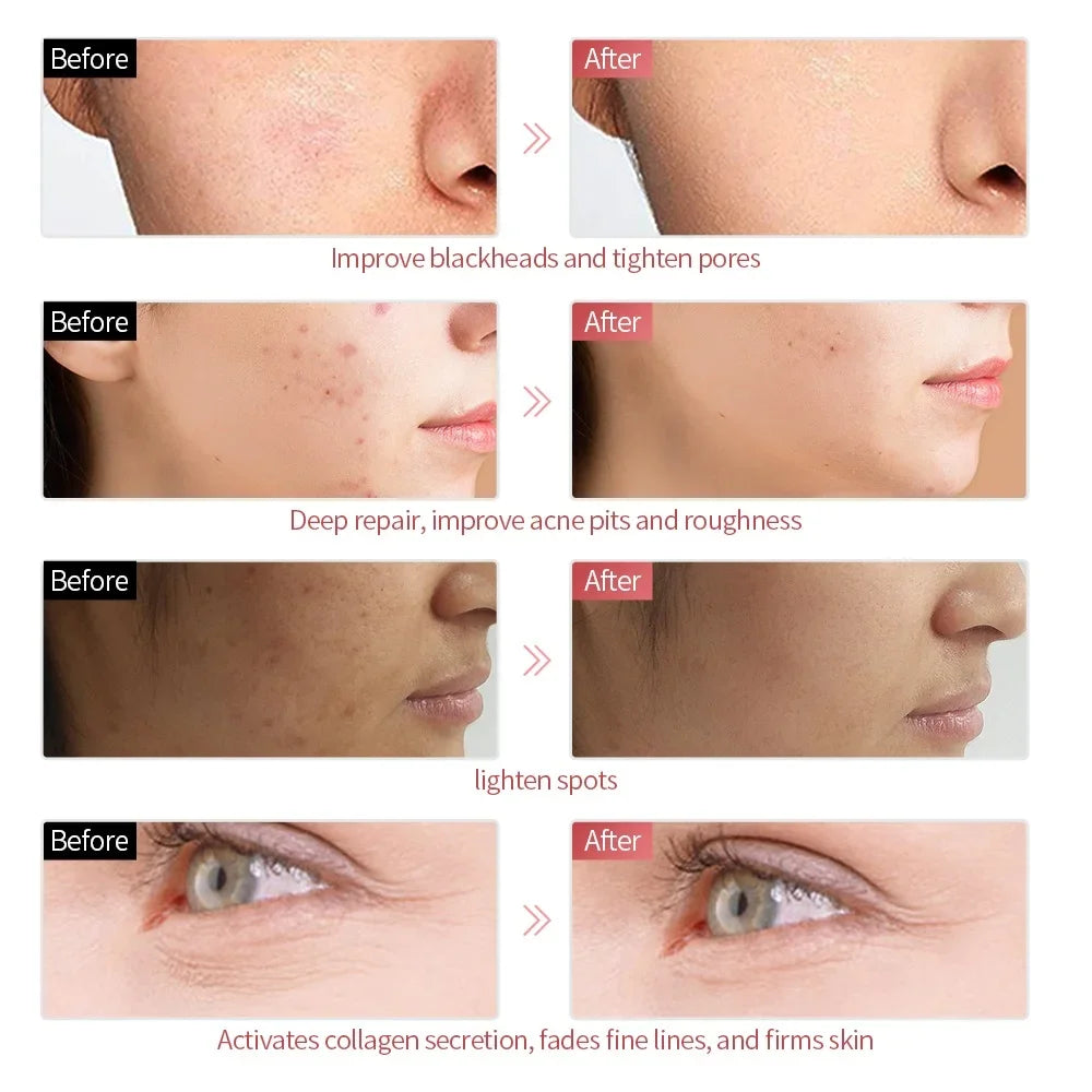 NNEOBA 7 Colors LED Facial Mask - Wireless Face Care Treatment